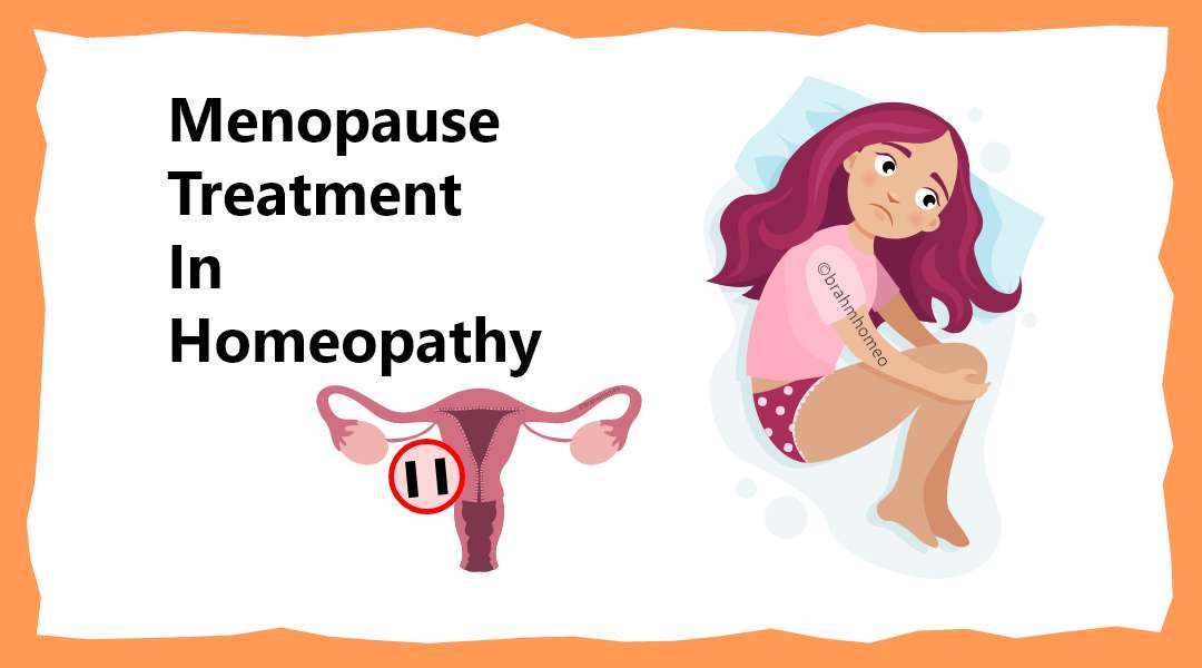 Menopause Treatment | Menopause Treatment In Homeopathy