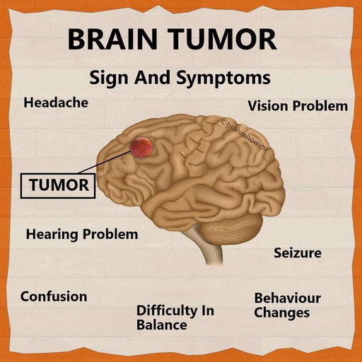best-BRAIN-TUMOR-TREATMENT