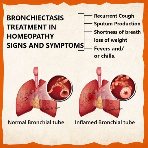 BRONCHIECTASIS-TREATMENT