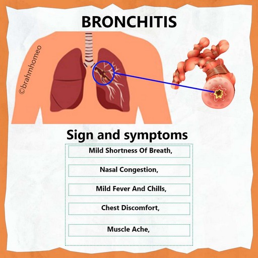 BRONCHITIS-ALLERGIC-TREATMENT