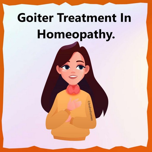 Goiter Treatment Goiter Treatment In Homeopathy