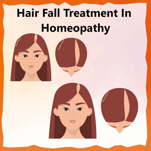 Hair-Fall-Treatment-in-Homeopathy