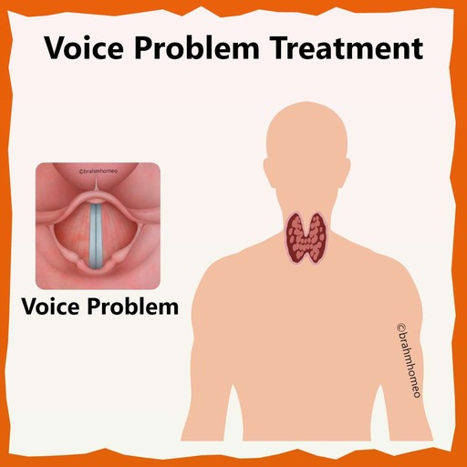 Vocal-cord-problem-treatment-in-homeopathy