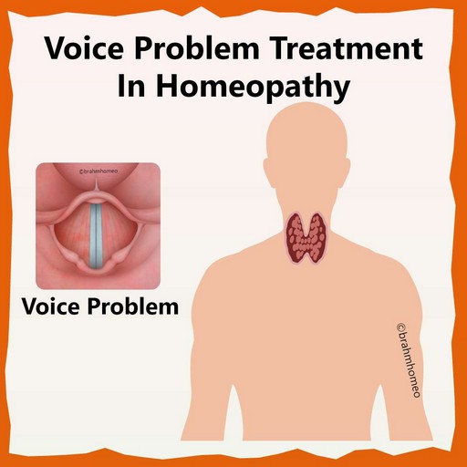 Vocal-cord-problem-treatment-in-homeopathy