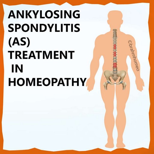 ankylosing-spondylitis-treatment-in-homeopathy