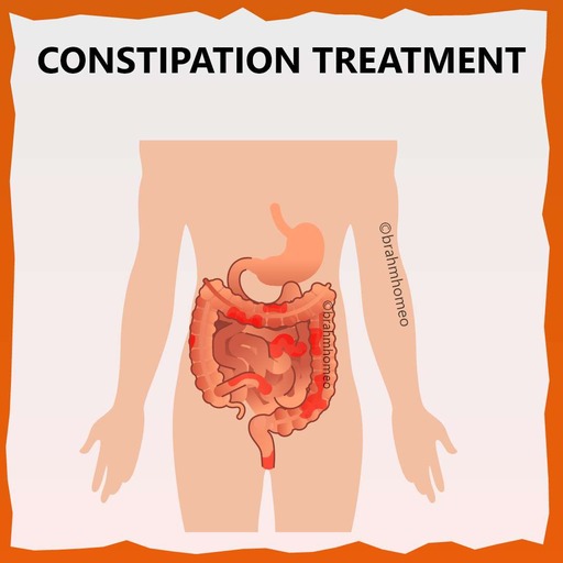 constipation-treatment-in-homeopathy