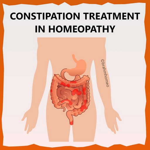 constipation-treatment-in-homeopathy