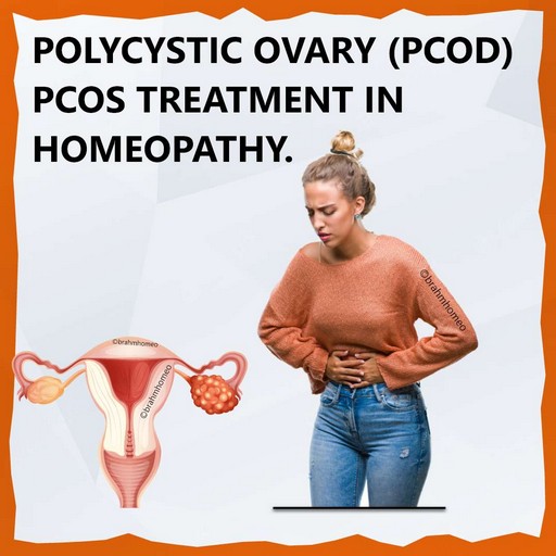 pcod-pcos-treatment-in-homeopathy