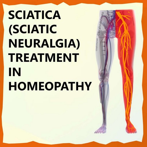 sciatica-treatment-in-homeopathy