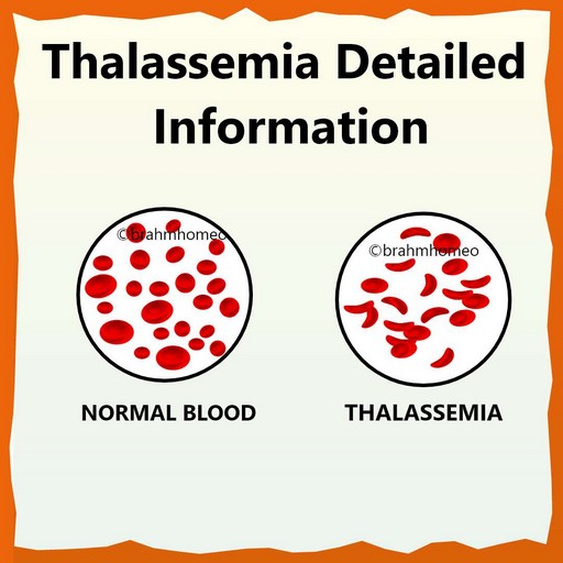 thalassemia-detailed-information