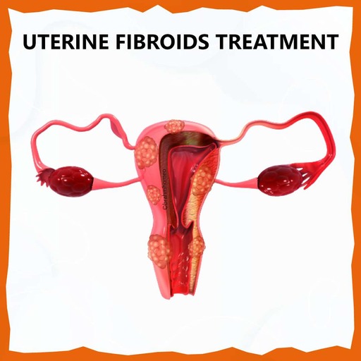 uterine-fibroids-treatment-in-homeopathy