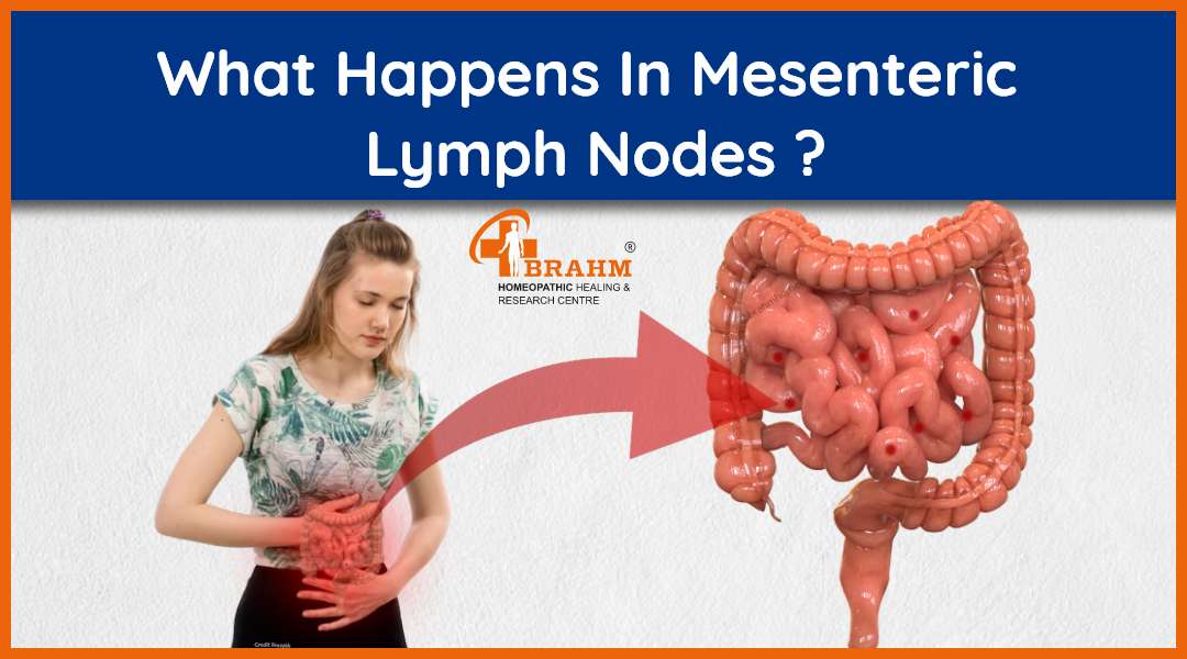 Mesenteric Lymph Nodes | Mesenteric Lymph Nodes Treatment In Homeopathy ...