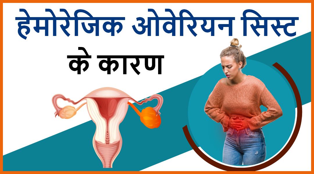 हेमोरेजिक सिस्ट कैसे ठीक करे |हेमोरेजिक सिस्ट कैसे ठीक करे बिना ऑपरेशन ...